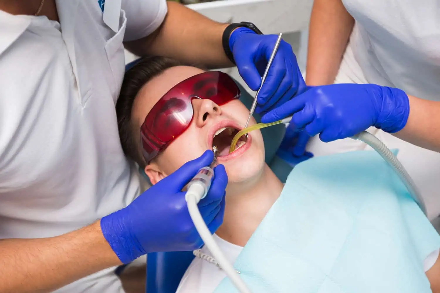 Wisdom Teeth Removal