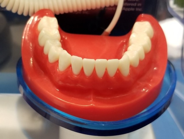 a-set-of-plastic-human-teeth-and-used-by-dentists-to-explain-gum-line-cavity- and-other-dental-problems