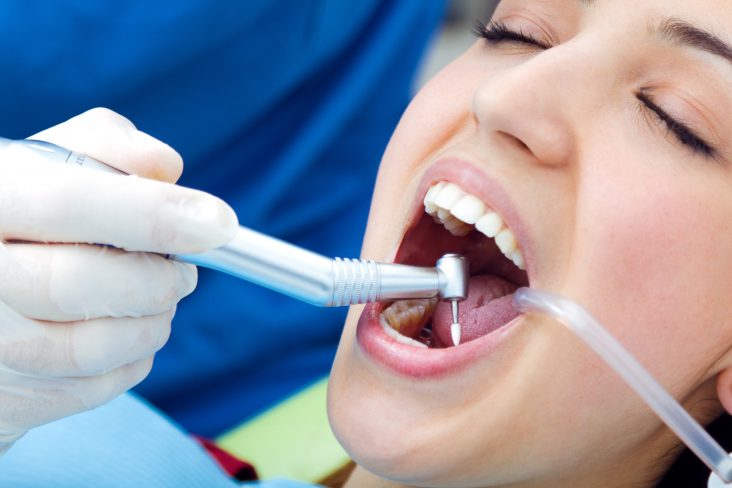 Teeth Polishing
