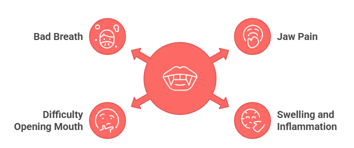Horizontally Impacted Wisdom Tooth Symptoms